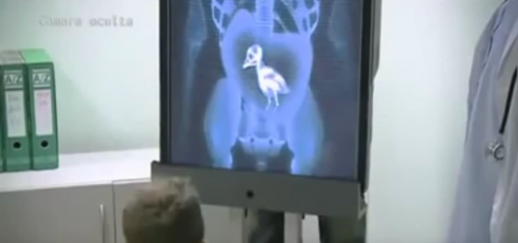 Filmé en caméra cachée, un faux médecin fait croire aux enfants que ce patient à un poussin dans le ventre !